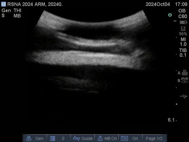 Sample scan 1