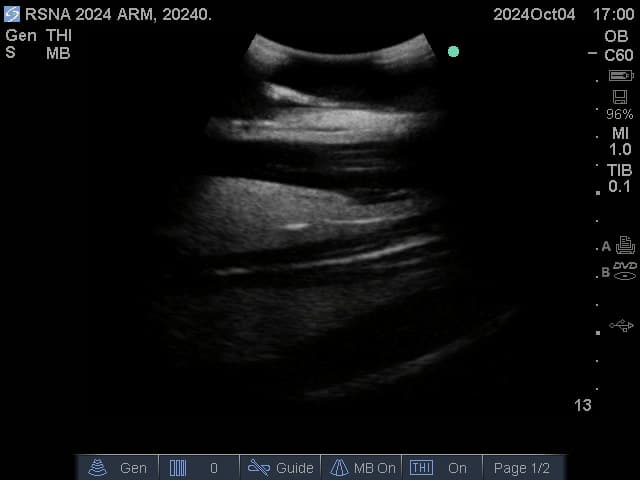 Sample scan 2