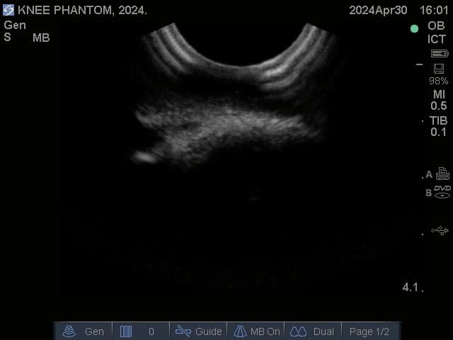 Sample scan 1