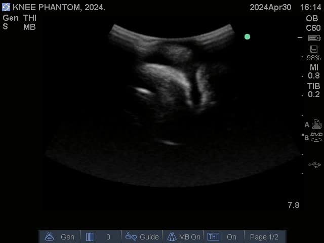 Sample scan 2