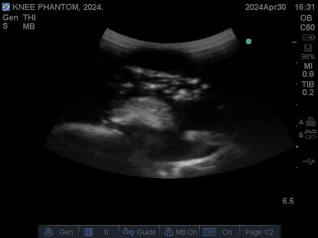 Sample scan 3