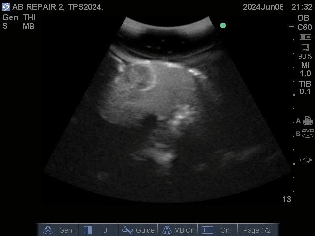 Sample scan 1