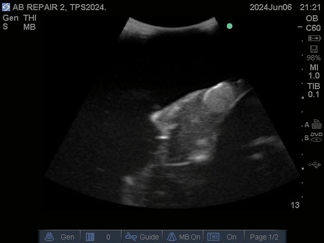 Sample scan 2