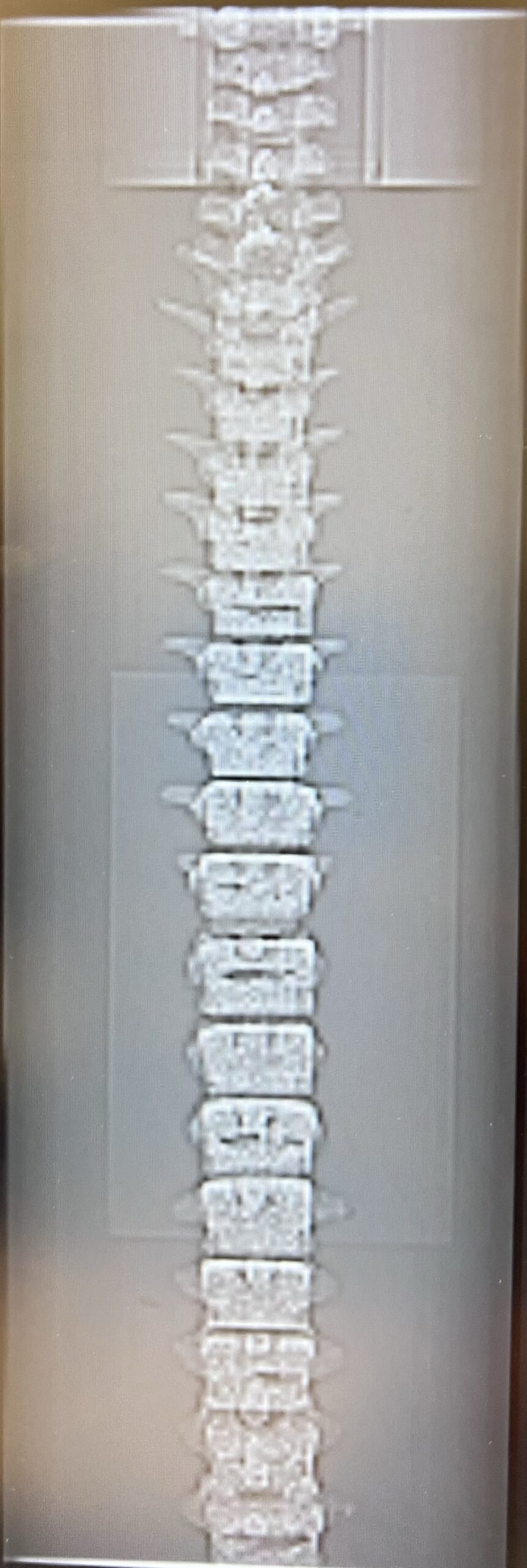Sample scan 2