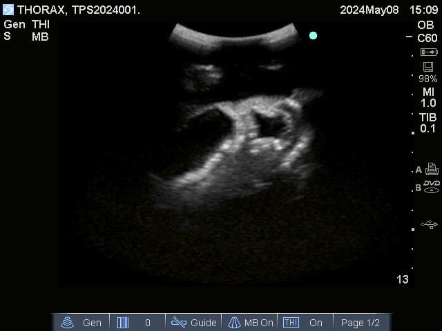 Sample scan 1