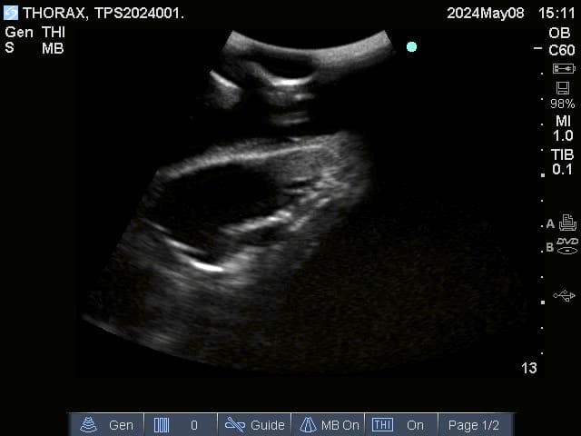 Sample scan 2