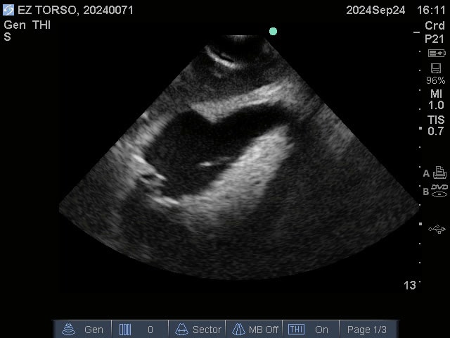 Sample scan 1