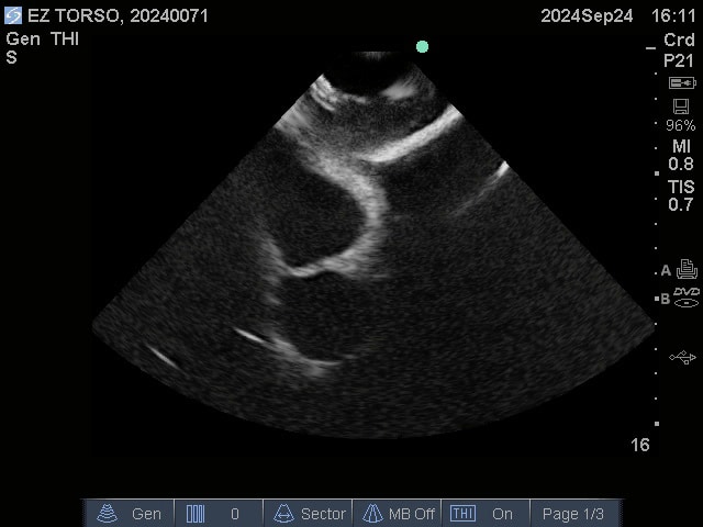 Sample scan 2