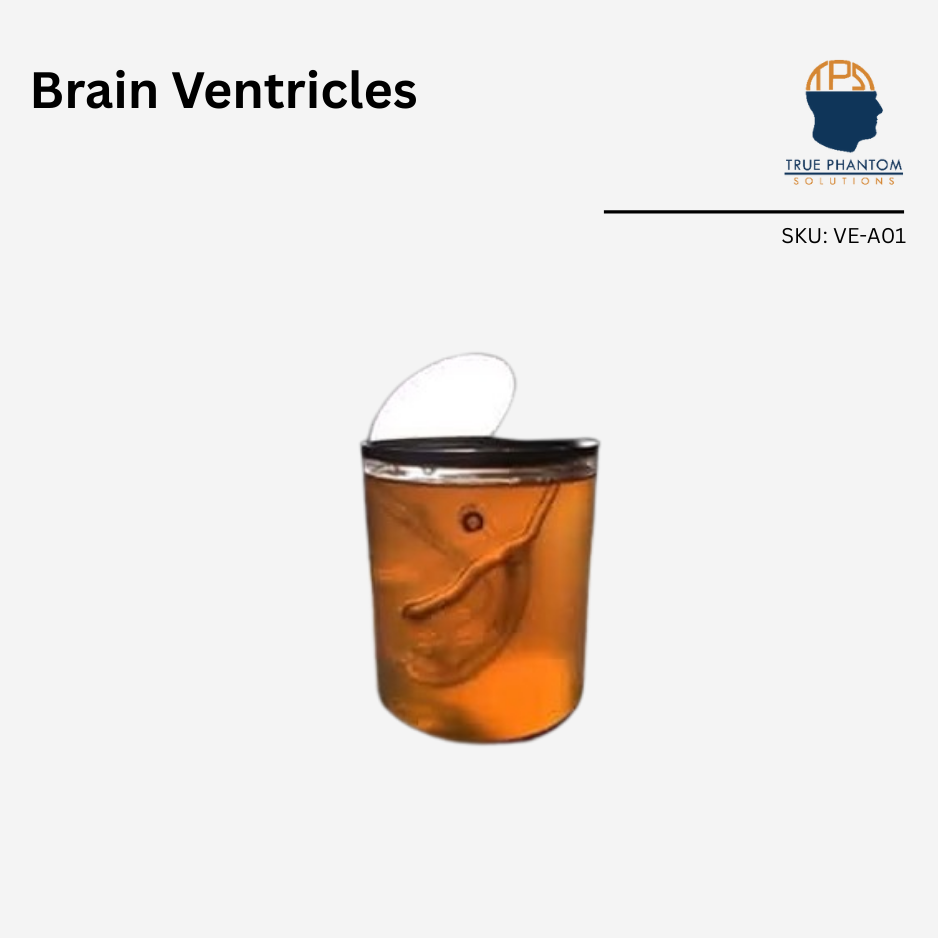 Brain Ventricles