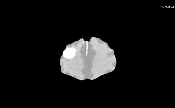 Sample scan 1