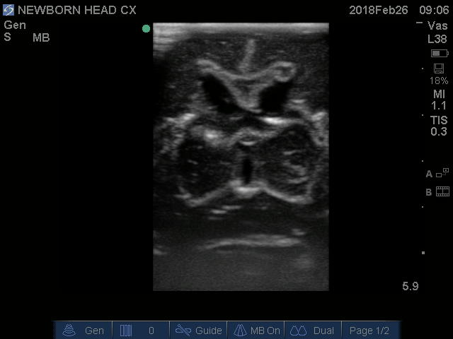 Sample scan 2