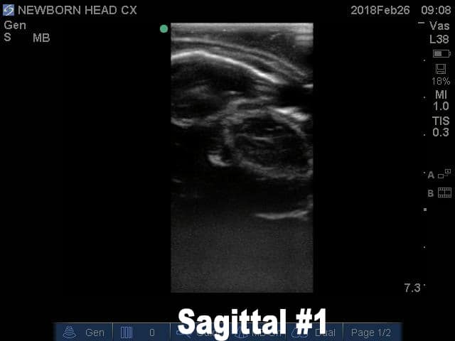Sample scan 3