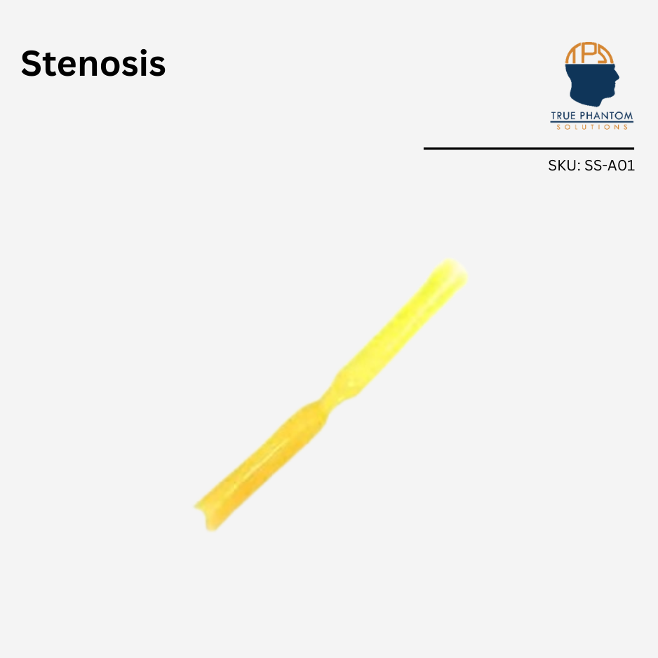 Stenosis