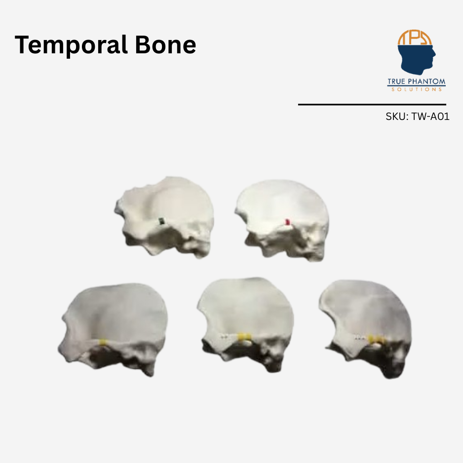 Temporal Bone